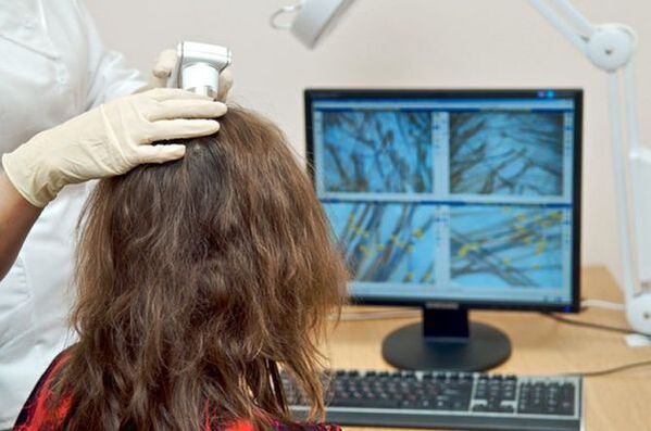 Vykonávanie diagnostickej trichoskopie