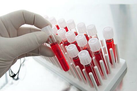 Krvný test na predpisovanie individuálnej liečby alopécie